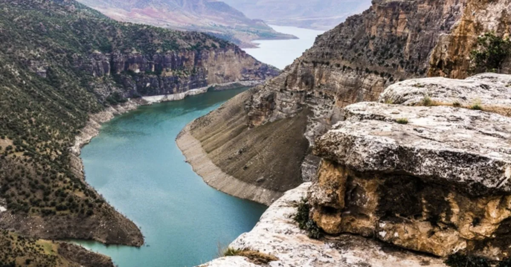 Siirt lazer epilasyon servisi