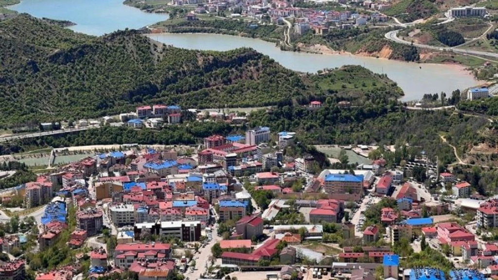 Tunceli lazer epilasyon servisi