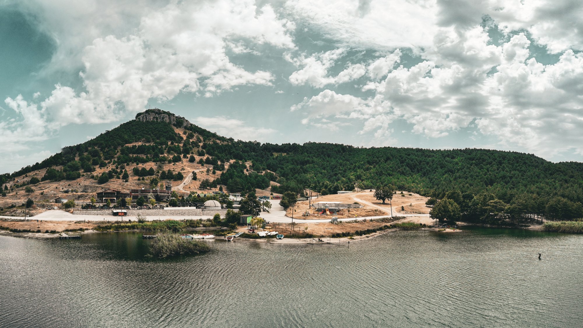 Gürsü lazer epilasyon teknik servisi