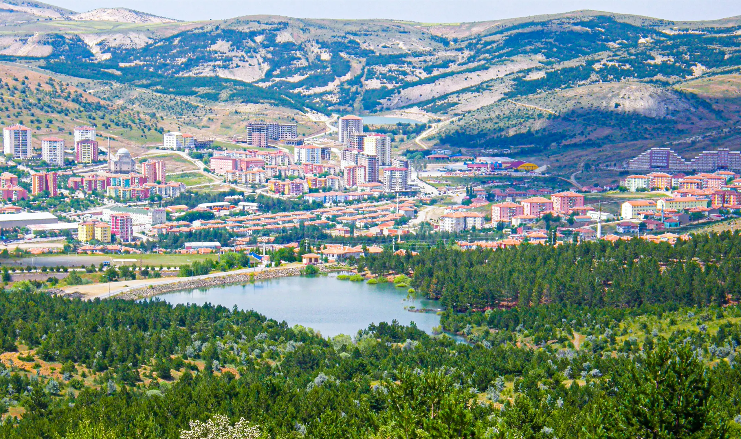 Yozgat lazer epilasyon servisi